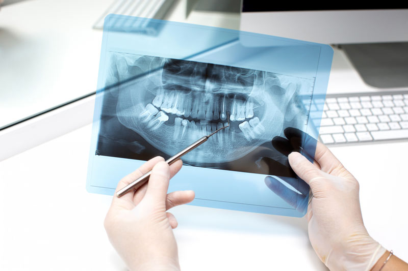 radiografia-cone-beam-cremona